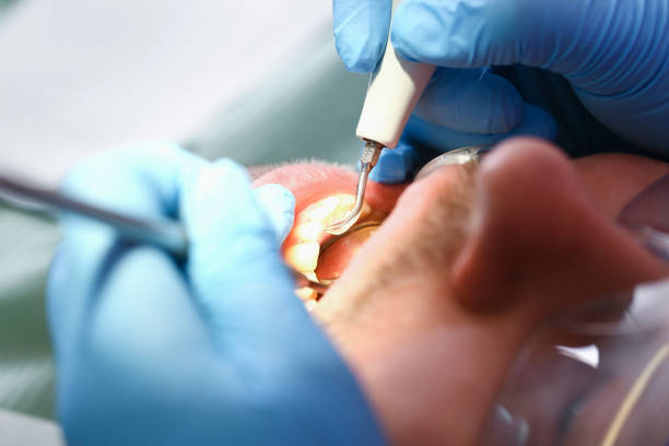 Best Emergency Treatment for Oral Infections in Hendron, KY